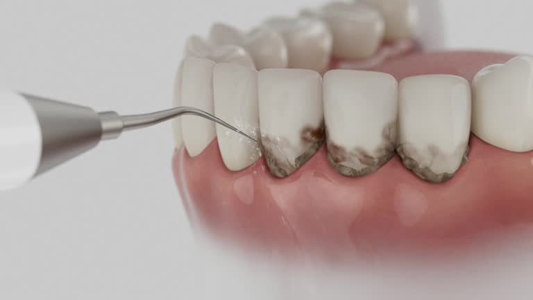 Trusted Invisalign Clear Aligners service in Sand Springs, OK - Dentist Open Now